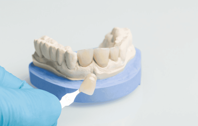Dental Crown In Littleton Colorado