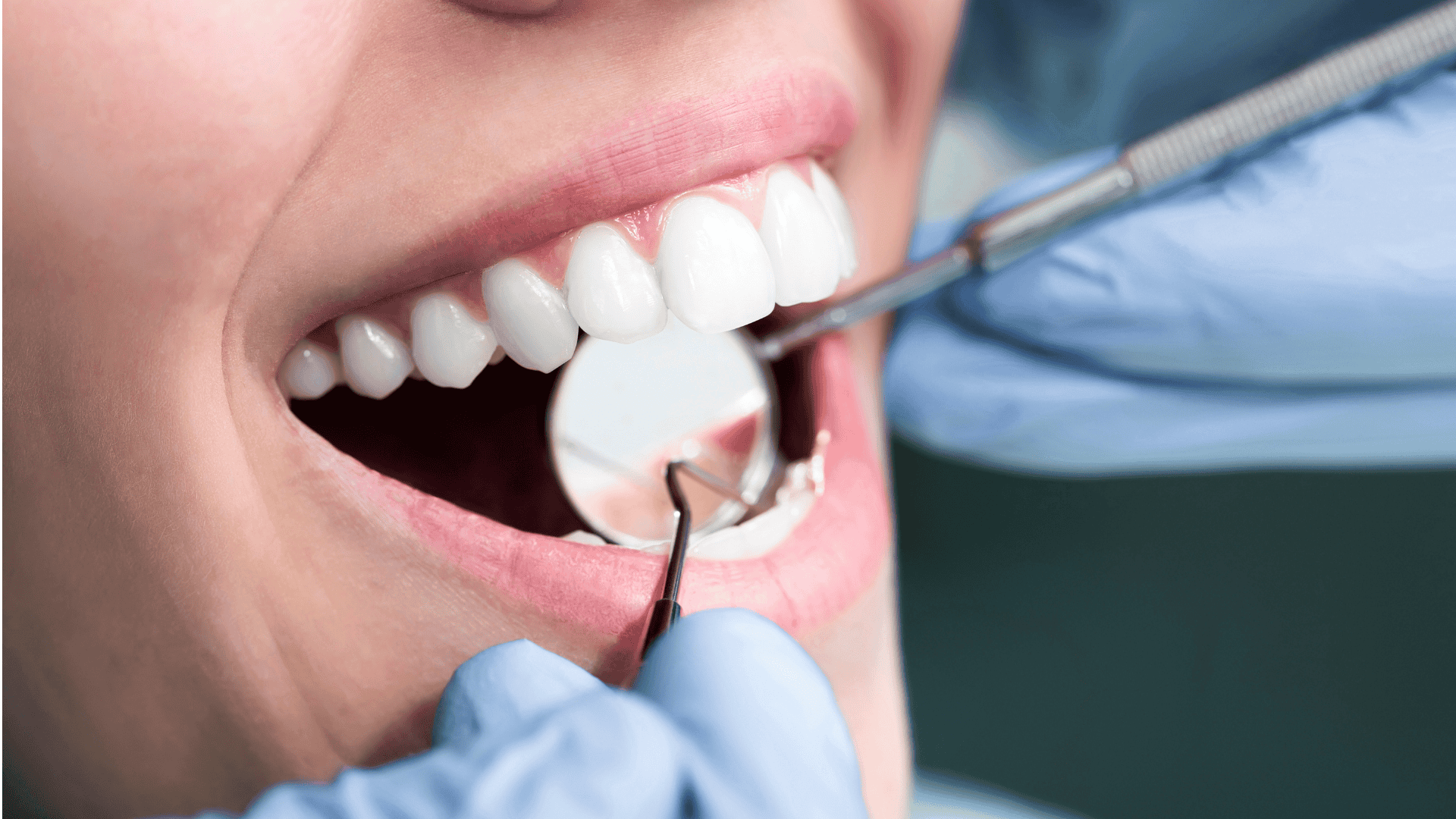Patient smile restored with a porcelain dental crown at Littleton Family Dental serving Littleton CO