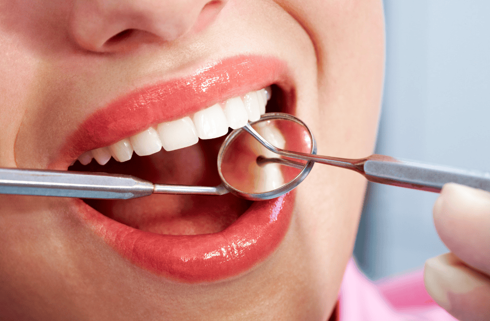 Dental Bonding - Littleton Co