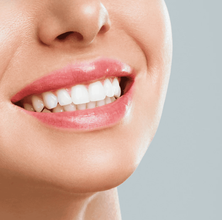 Patient smile after cosmetic dental bonding at Littleton Family Dental serving Littleton CO