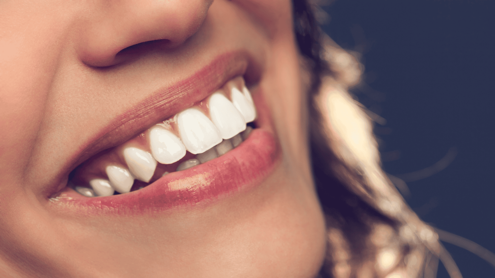 all on 4 dental implants in Littleton Co