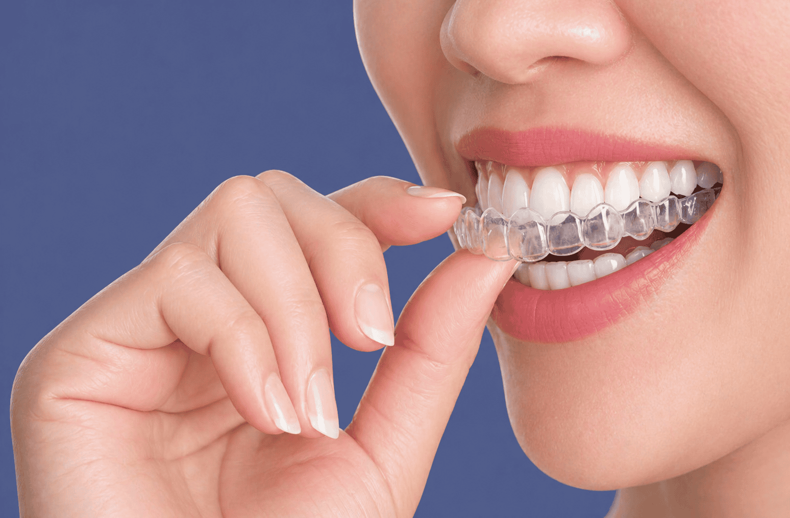 Invisalign Treatment For Straighter Teeth - Littleton Family Dental