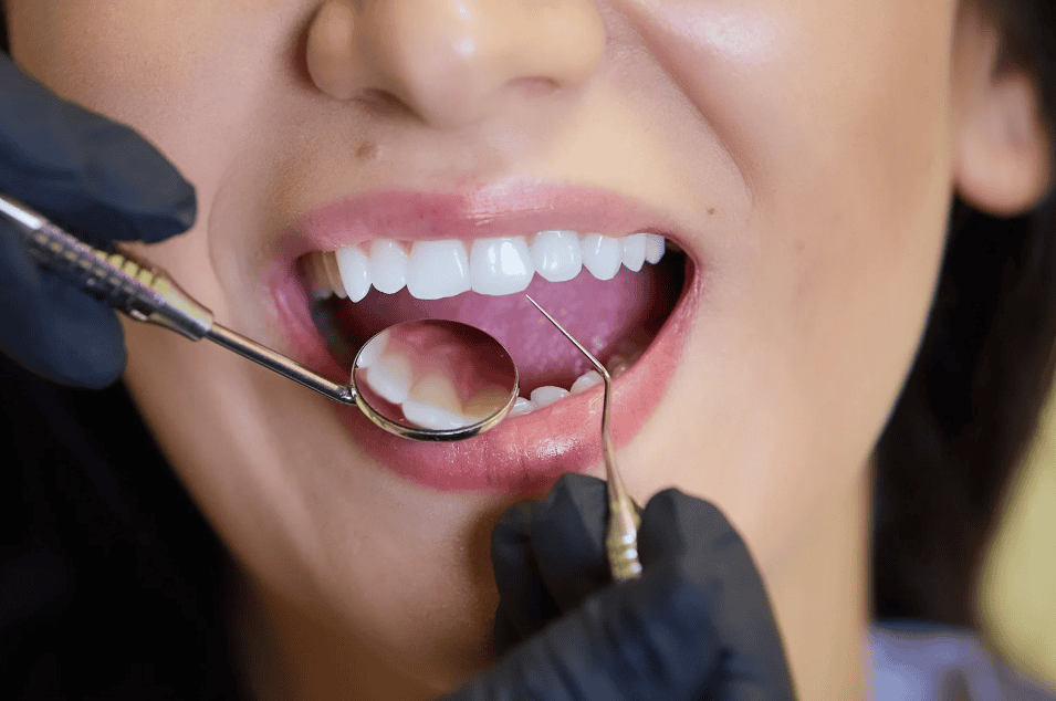 Sedation Dentistry in Littleton Colorado