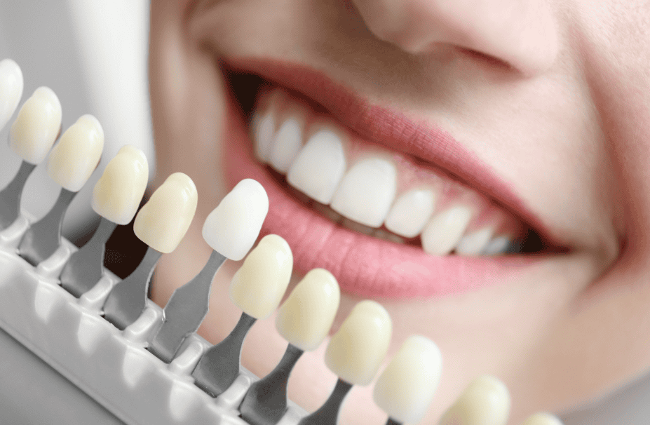 Teeth Whitening In Littleton Co