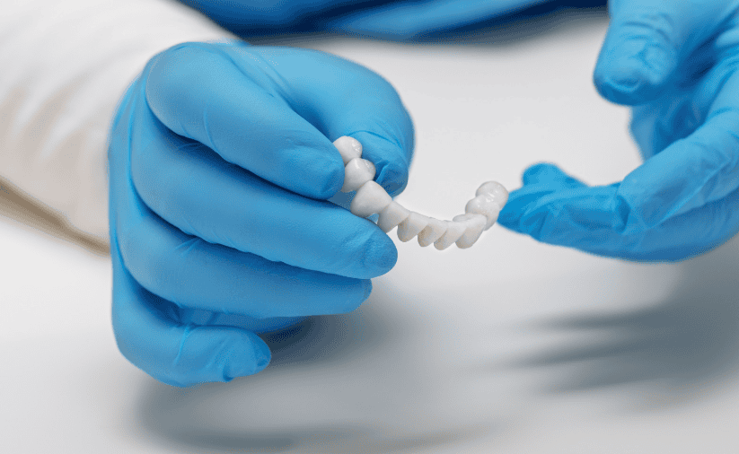 Missing a tooth? Dr. Anne Casson replaces missing teeth with custom dental bridges in Littleton, CO. Restore your bite and your smile. Book today.